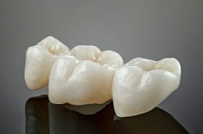 metal-free-ceramic-dental-crowns-2023-11-27-04-57-52-utc-300x132